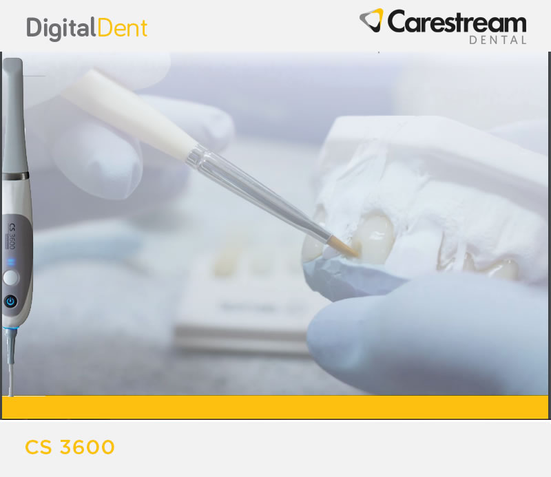 DigitalDent