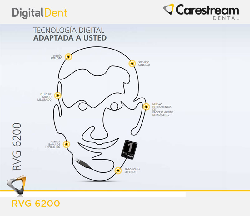 DigitalDent
